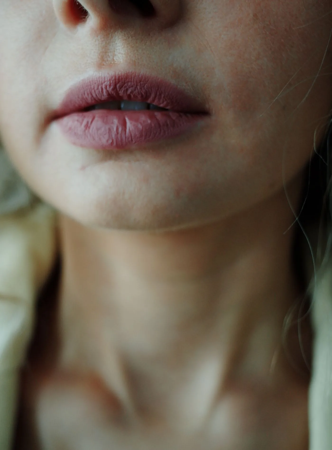 Natürliche, ungeschminkte Lippen und Kinn einer Frau in der Nahaufnahme, Modellaufnahme zur Hyaluronsäure Behandlung in Düsseldorf