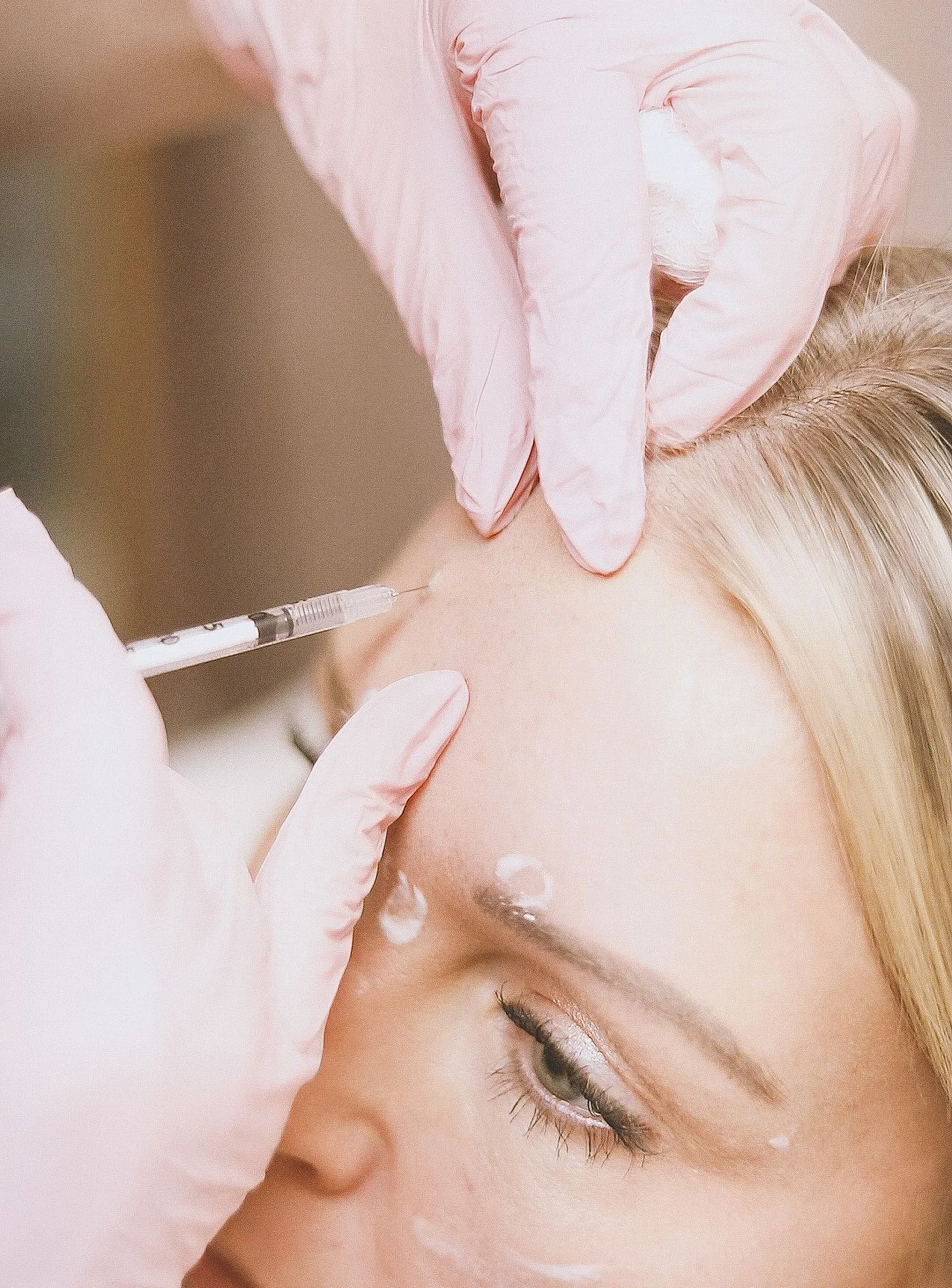 Feine Injektion an der Stirn mit rosa Handschuhen, Modellaufnahme zur Botox Behandlung in Düsseldorf