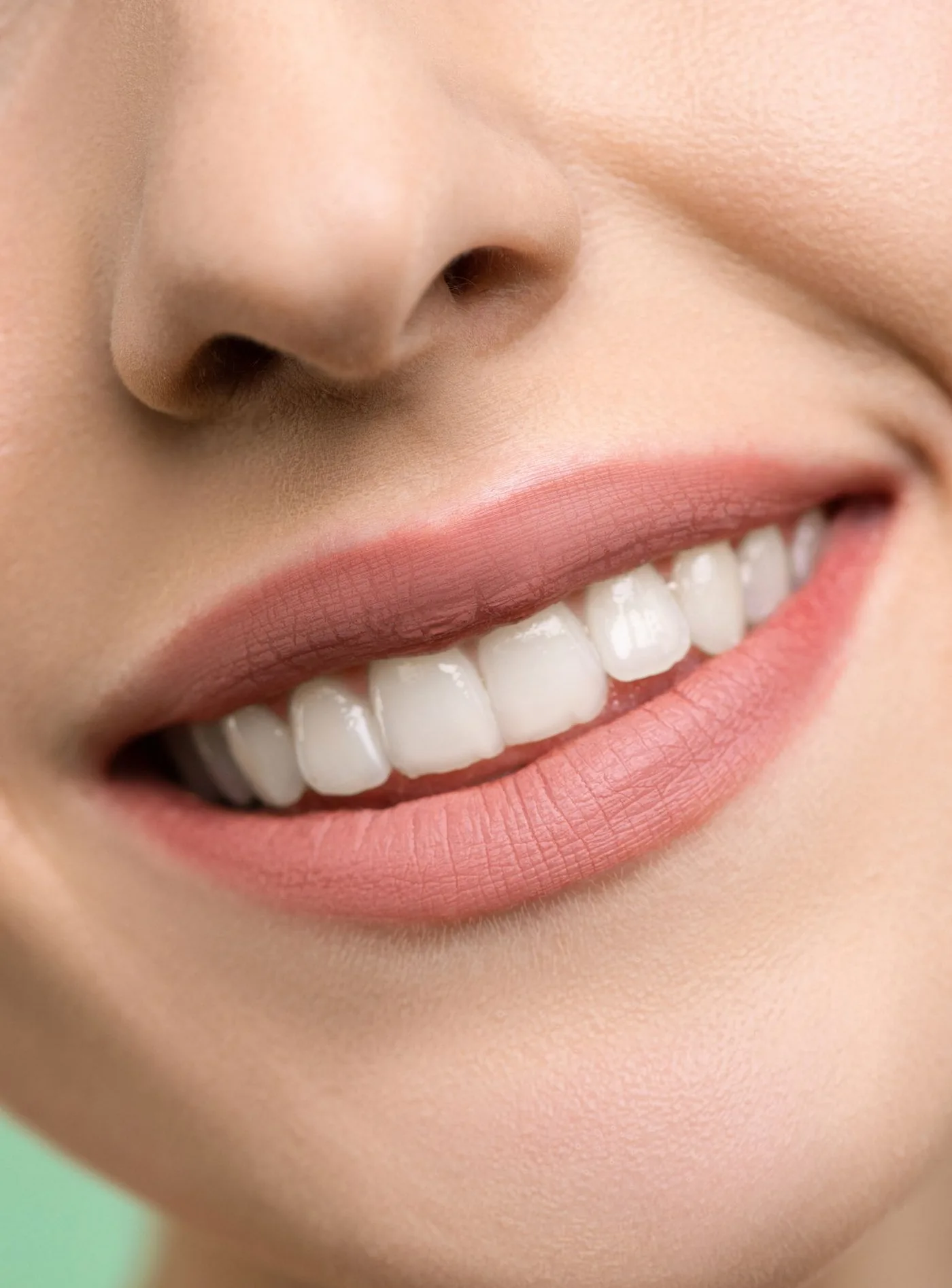 Lächelnder Mund mit natürlichen Lippen und weißen Zähnen in der Nahaufnahme, Modellaufnahme zum Lip Lift in Düsseldorf