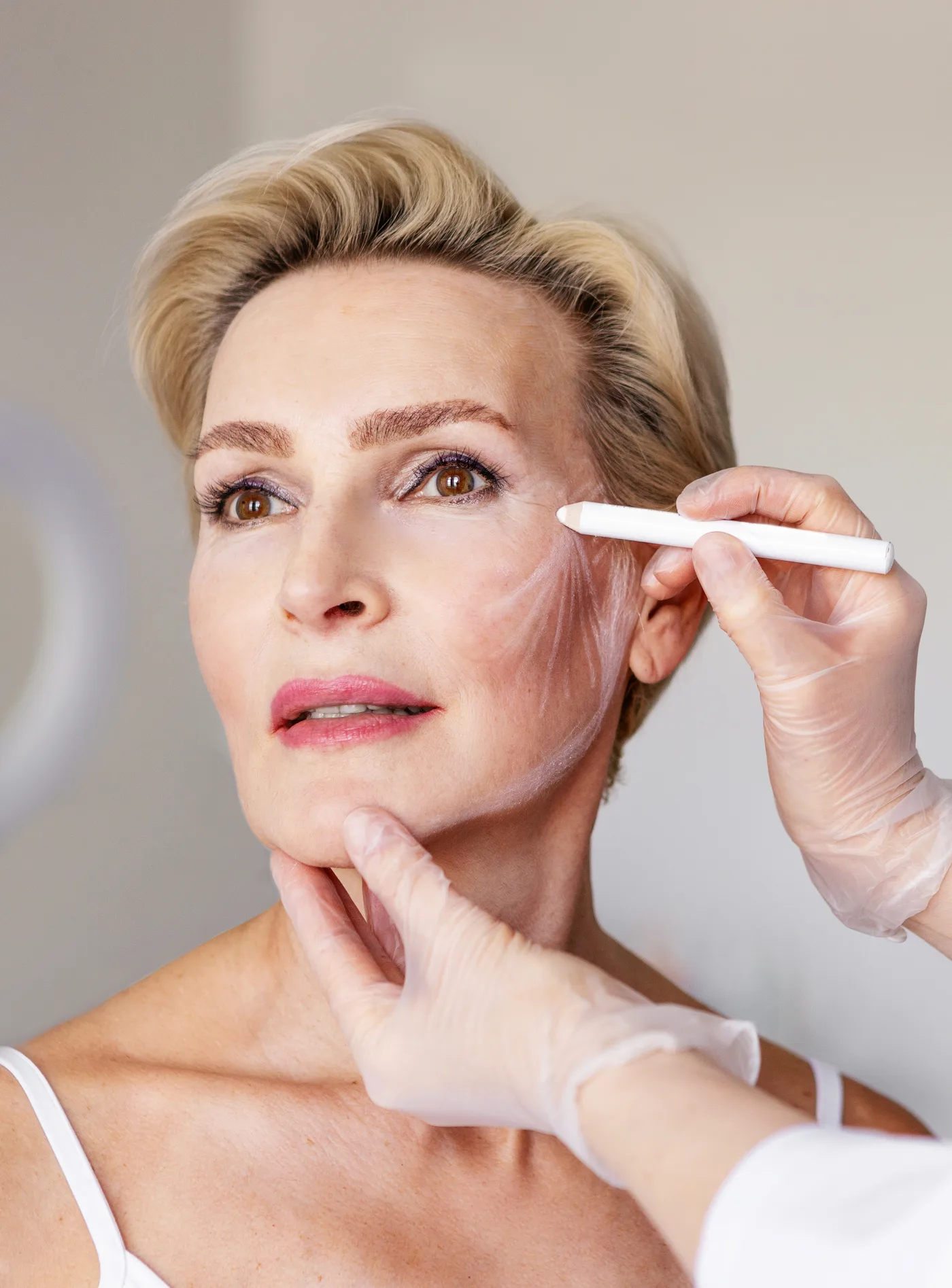 Reife Frau, ein Arzt zeichnet mit einem Stift die Behandlungslinien an der Wange ein, Planung vor dem Facelift, Modellaufnahme, Düsseldorf
