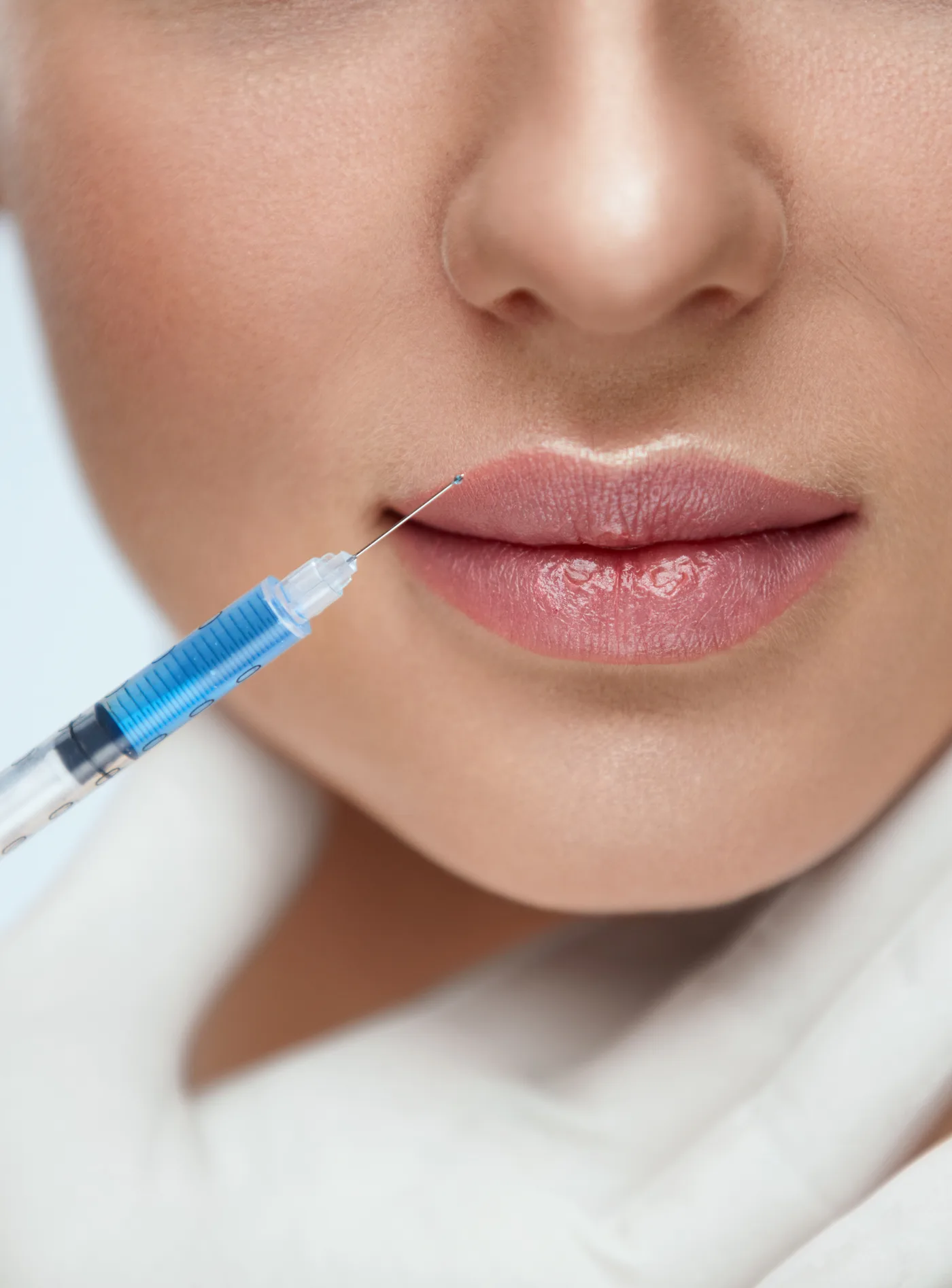 Spritze mit Hyaluronsäure an der Oberlippe, Lippenunterspritzung, Modellaufnahme zur Hyaluronsäure Behandlung in Düsseldorf